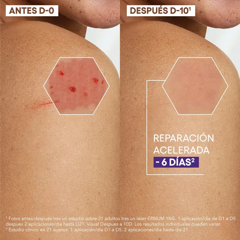 A-Derma Exomega Epithelial Ah Crema anti-cicatrici ultra-riparatrice 40 ml