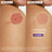 A-Derma Exomega Epithelial Ah Crema anti-cicatrici ultra-riparatrice 40 ml