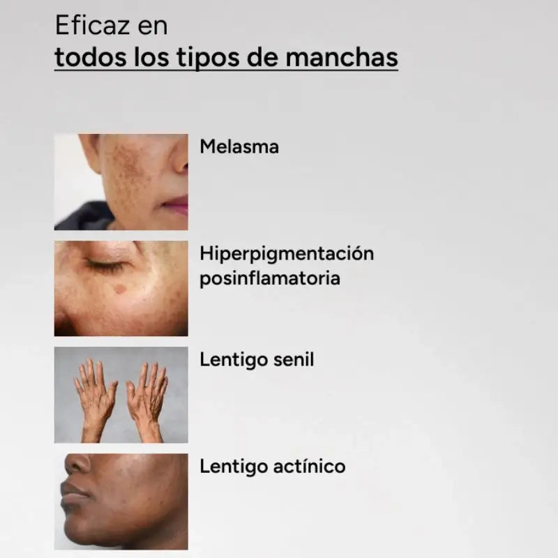 Acm Laboratoires Depiwhite Siero concentrato intensivo anti-macchie, 30 ml