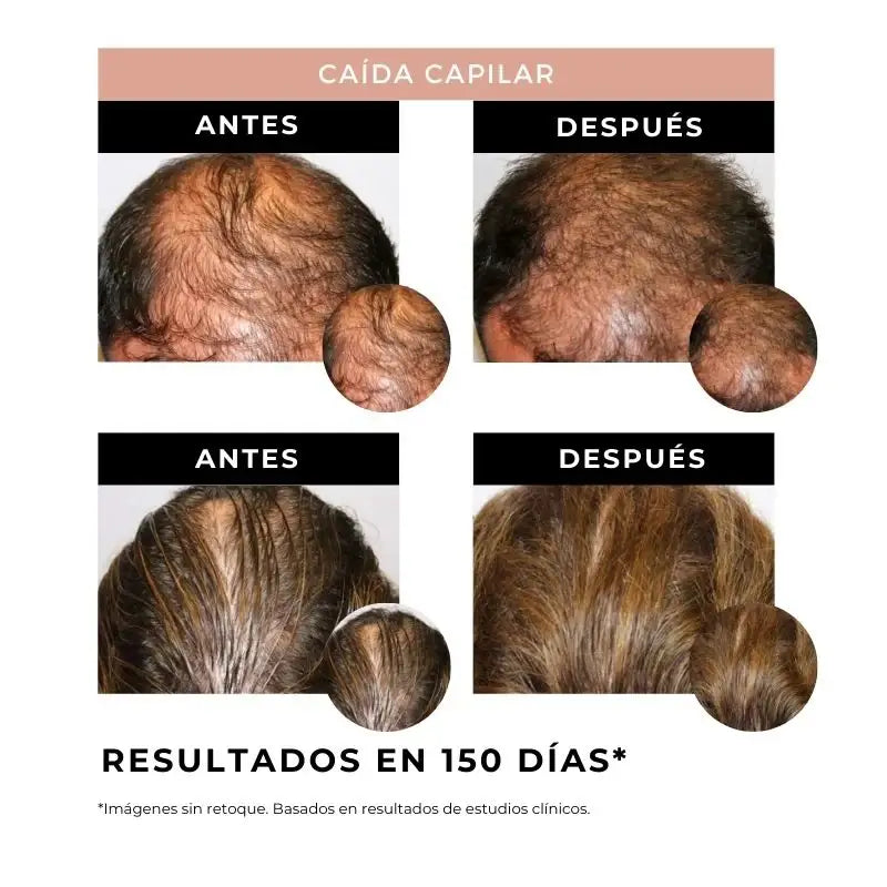 Arganour Lozione per la crescita dei capelli, 50 Ml