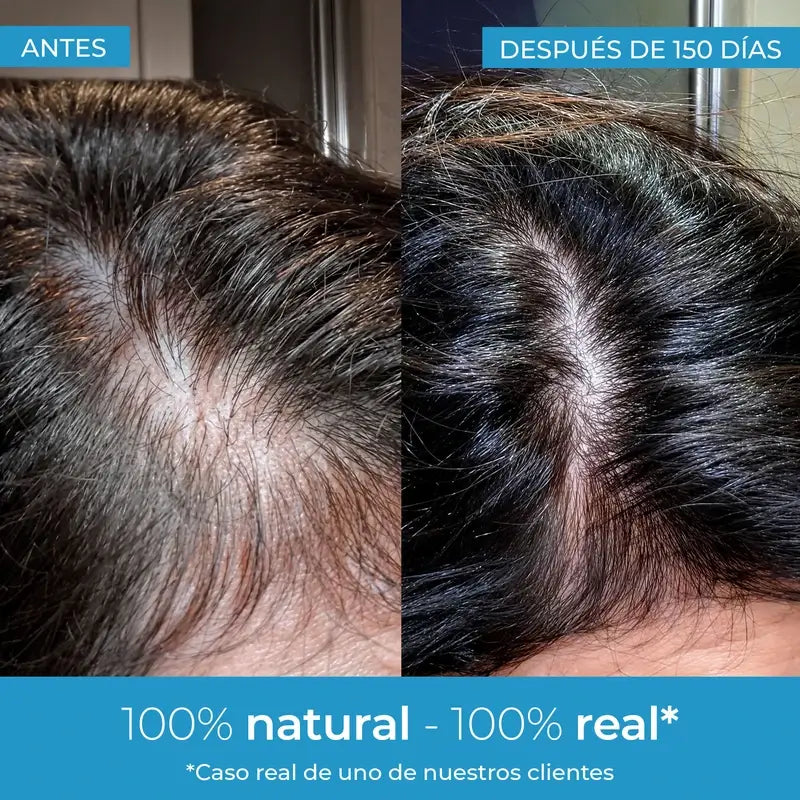 Arganour Lozione per la crescita dei capelli, 50 Ml