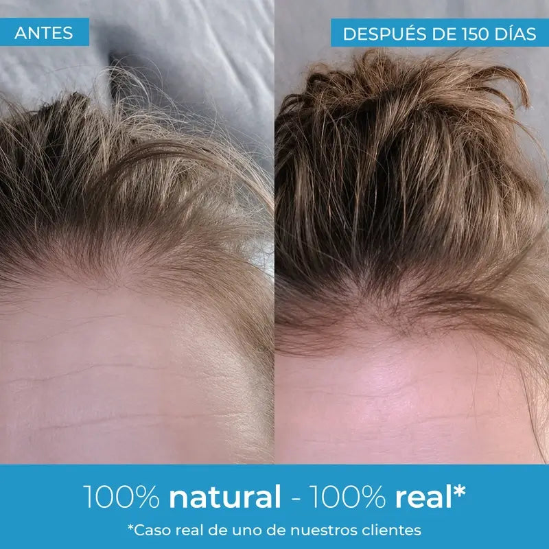 Arganour Lozione per la crescita dei capelli, 50 Ml