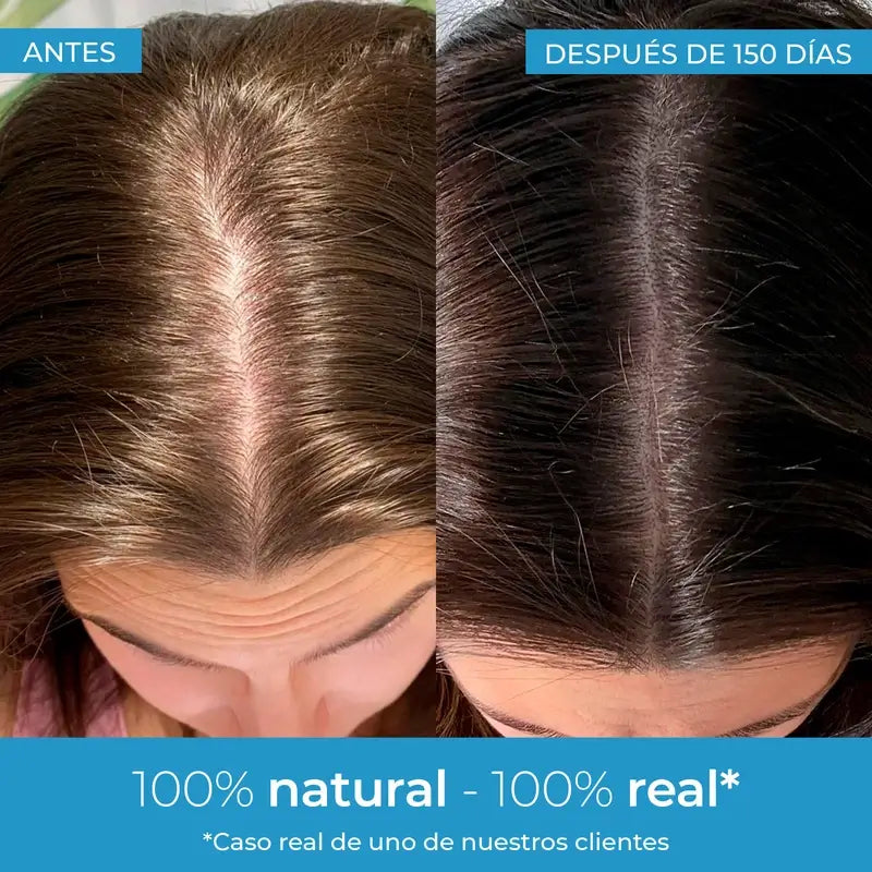 Arganour Lozione per la crescita dei capelli, 50 Ml