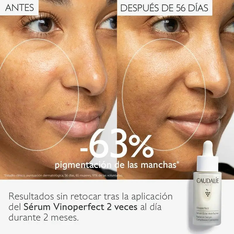 Caudalie Vinoperfect Siero Radioso Anti-Blemish 30 ml
