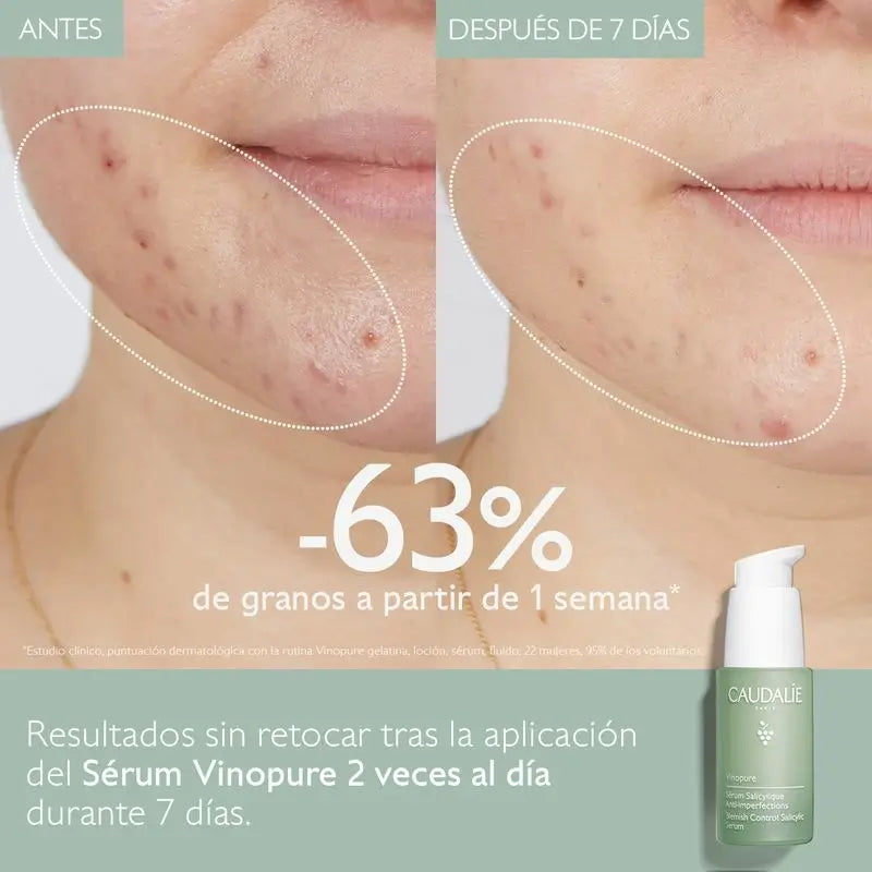 Caudalíe Vinopure Siero Salicilico Anti-Imperfezioni - 30 ml