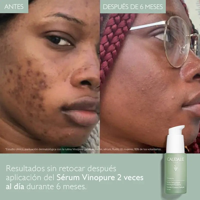 Caudalíe Vinopure Siero Salicilico Anti-Imperfezioni - 30 ml
