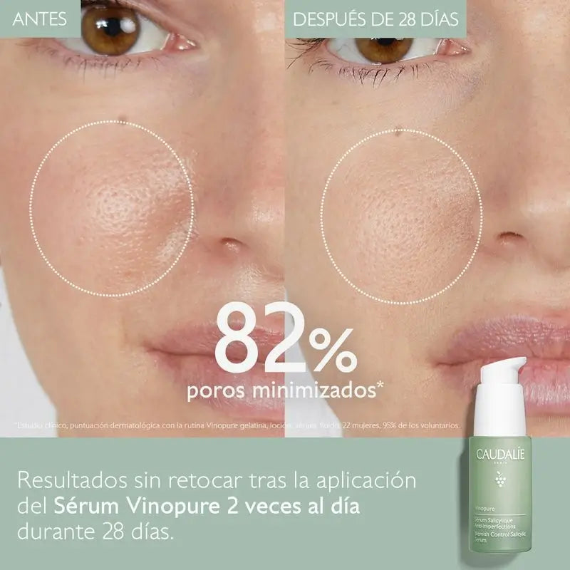 Caudalíe Vinopure Siero Salicilico Anti-Imperfezioni - 30 ml