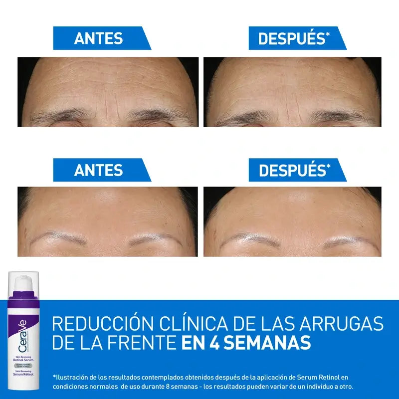 Cerave Skin Renewing Anti-Aging Retinol Serum, 30 ml