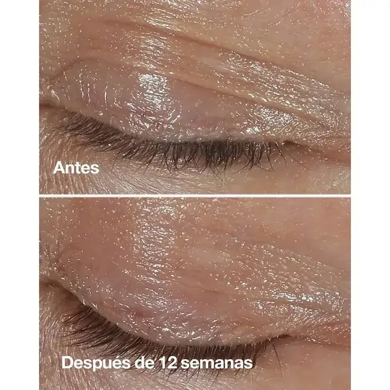 Clinique Smart Clinical Repair Crema occhi correttiva antirughe, 2x15 ml