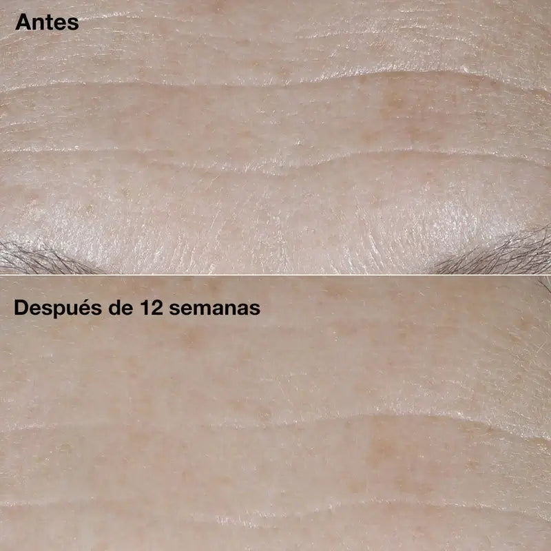 Clinique Smart Clinical Repair Crema Anti-Età SPF30, 50 ml