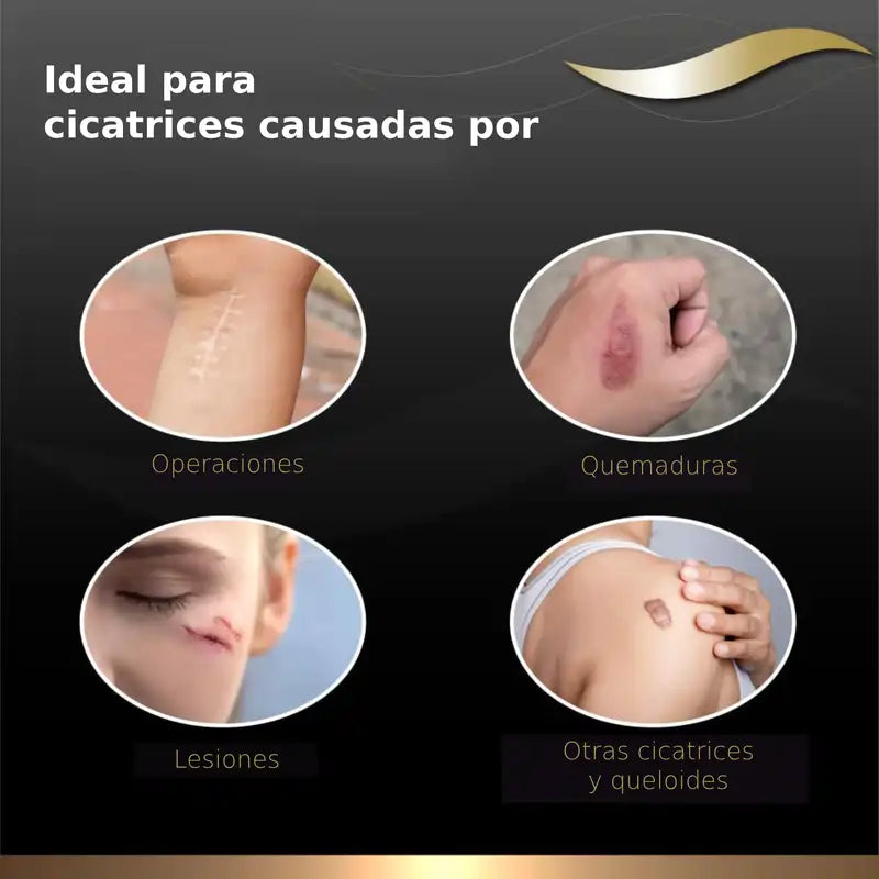 Dermatix Gel di silicone per il trattamento delle cicatrici, 15 g