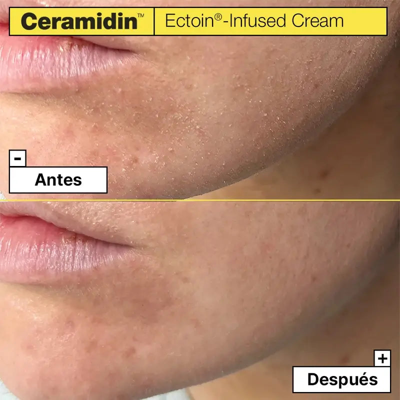 Dr. Jart+ Ceramidin Crema idratante per il viso con Ectoin, 50 ml