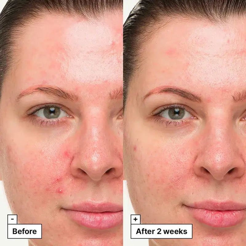 Dr.Jart+ Crema-Gel Trattamento Lenitivo, 30 ml
