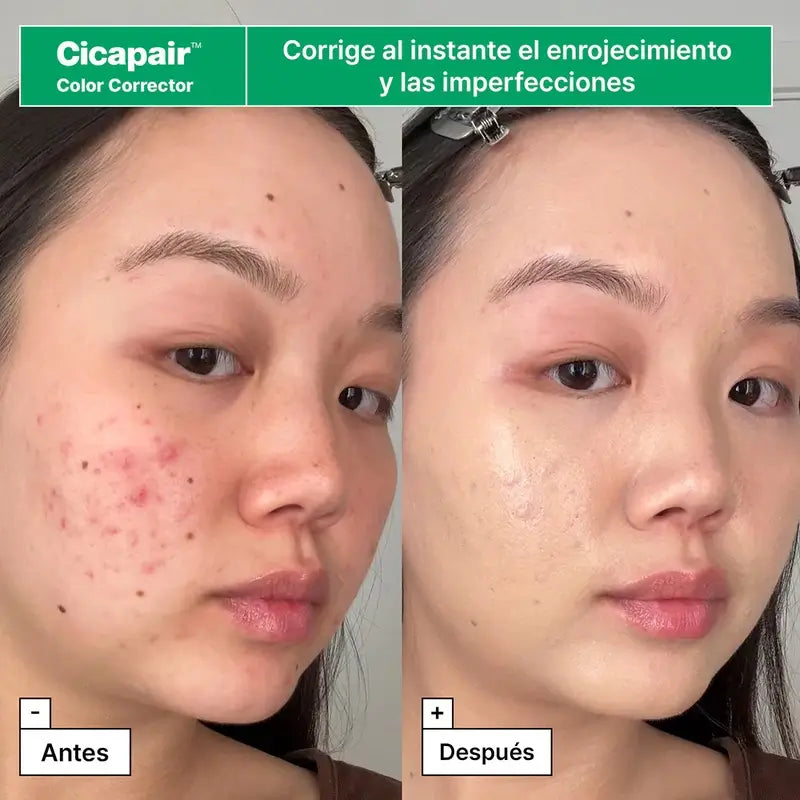 Dr.Jart+ Kit di soccorso per la pelle arrossata con Centella asiatica