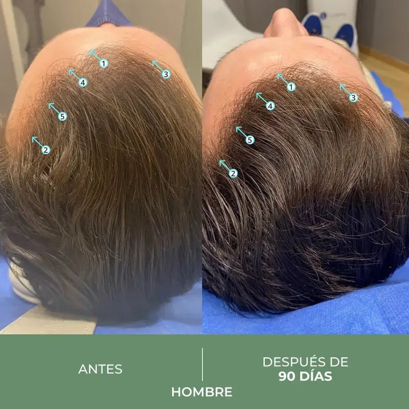 Ds Laboratories Revita Cbd Shampoo antiossidante e stimolante contro la perdita di capelli, 205 ml