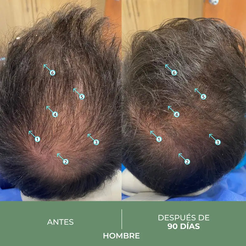 Ds Laboratories Revita Cbd Shampoo antiossidante e stimolante contro la perdita di capelli, 205 ml
