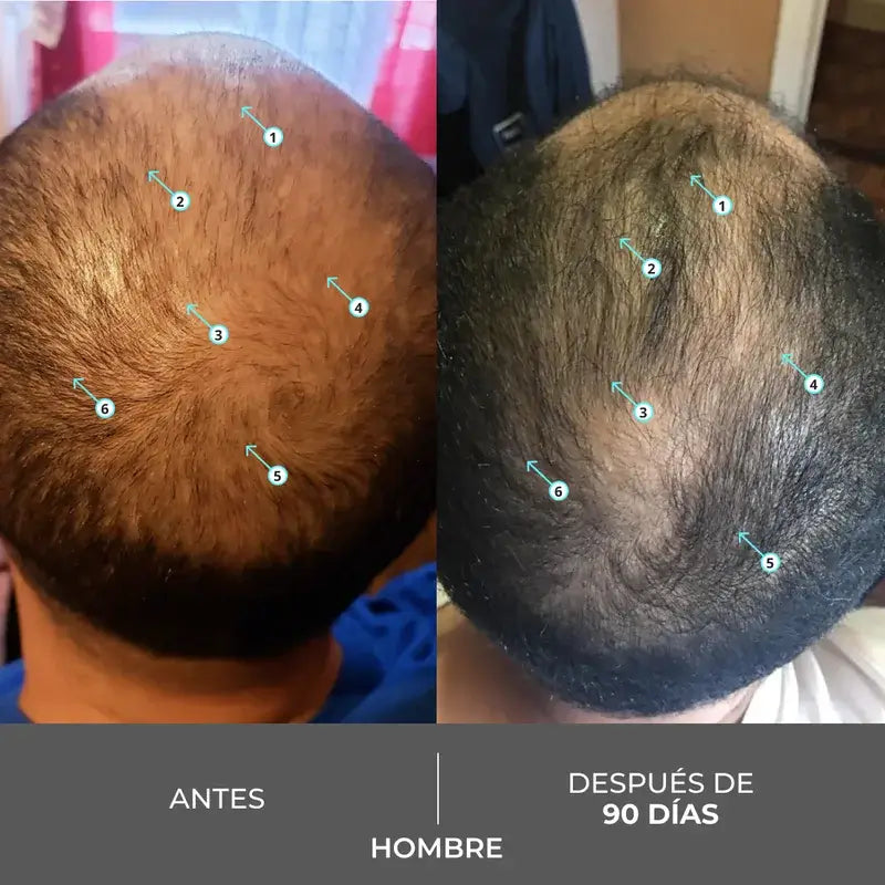 Ds Laboratories Revita Shampoo stimolante della densità dei capelli e della perdita di capelli, 205 ml