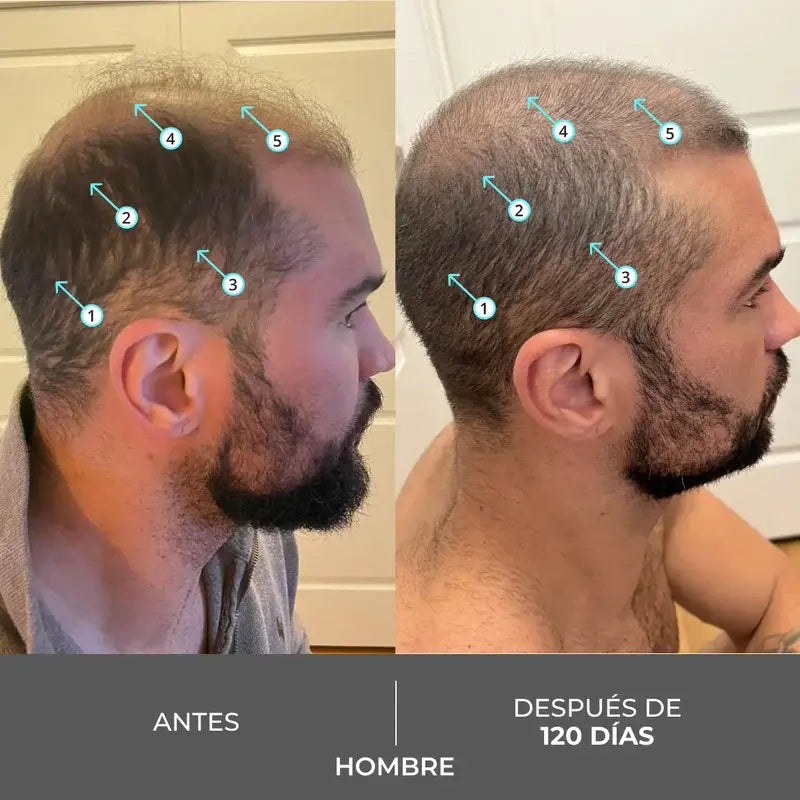 Ds Laboratories Revita Shampoo stimolante della densità dei capelli e della perdita di capelli, 205 ml