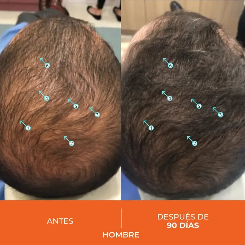 Ds Laboratories Revita Compresse Anticaduta, 30 pz.