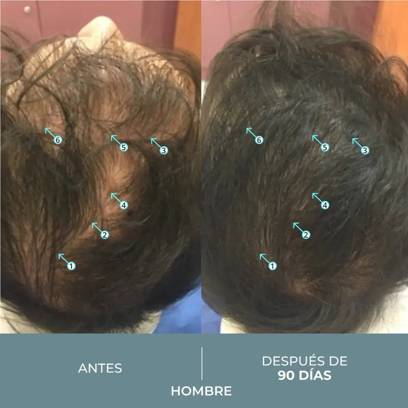 Ds Laboratories Revita Sod Compresse Anti-Caduta, 30 pz.