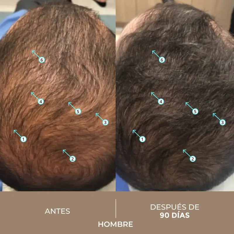 Ds Laboratories Spectral Lotion Dnc-N 3 Month Hair Loss Treatment con Nanoxidil® 5%, 180 ml