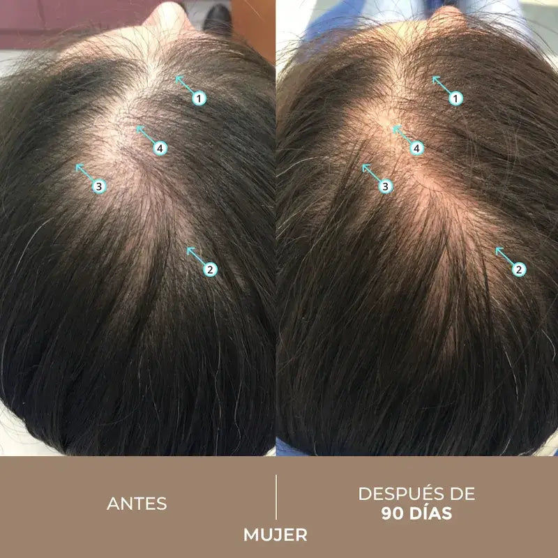 Ds Laboratories Spectral Lotion Spectral Dnc-N 5% Nanoxidil® Trattamento per la perdita dei capelli, 60 ml