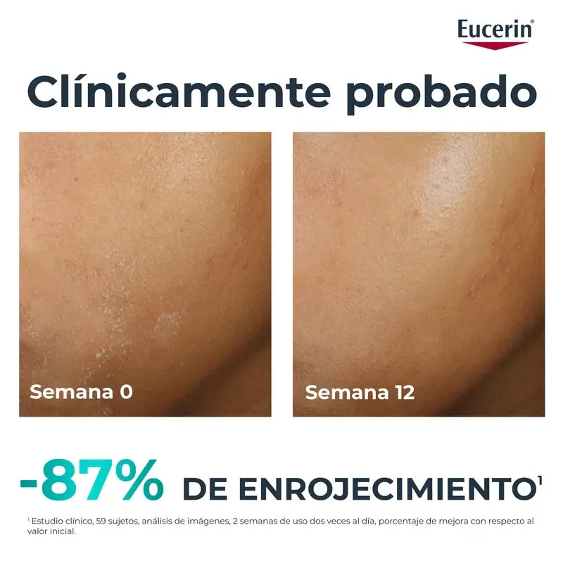 Eucerin Dermopure Oil Control Hydra Repair Coadiuvante, 50 ml