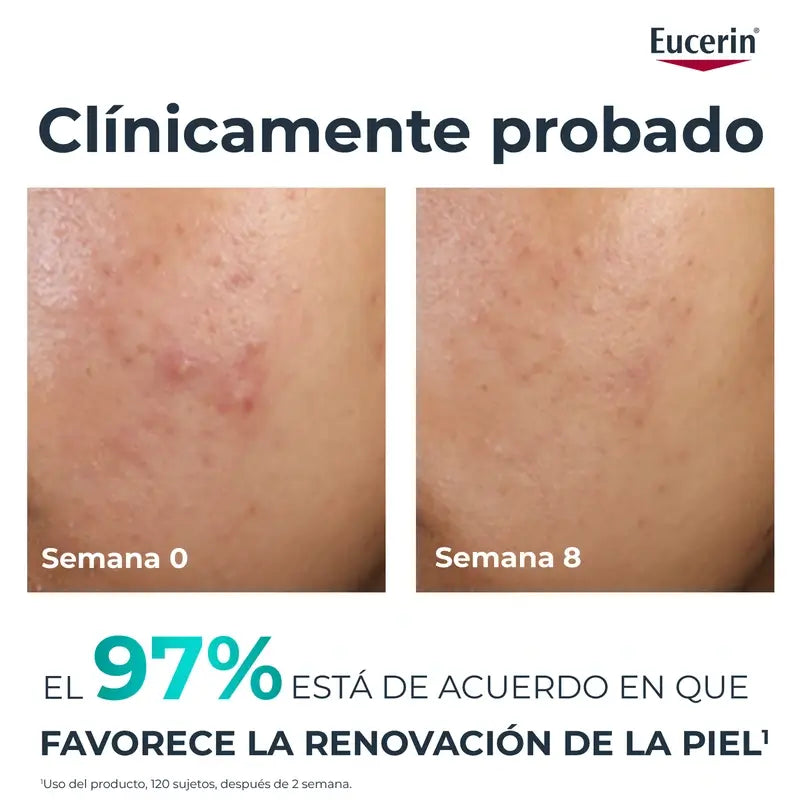 Eucerin Dermopure Peeling 10% Idrossiacidi, 40 ml