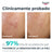 Eucerin Dermopure Peeling 10% Idrossiacidi, 40 ml