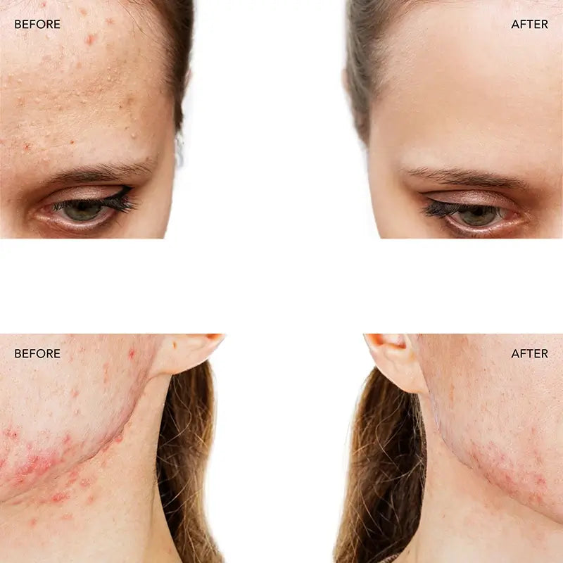 Foreo Espada™ 2 Rosa perlato