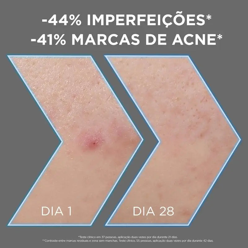 Garnier Siero Anti-Perfezioni con 4% di Niacinamide, Aha e Bha, 30ml