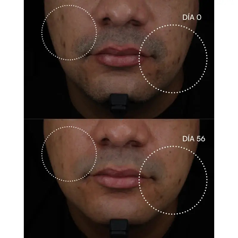 Peeling chimico Gema Herrerías 10 Aha, 20 unità