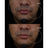 Peeling chimico Gema Herrerías 10 Aha, 20 unità