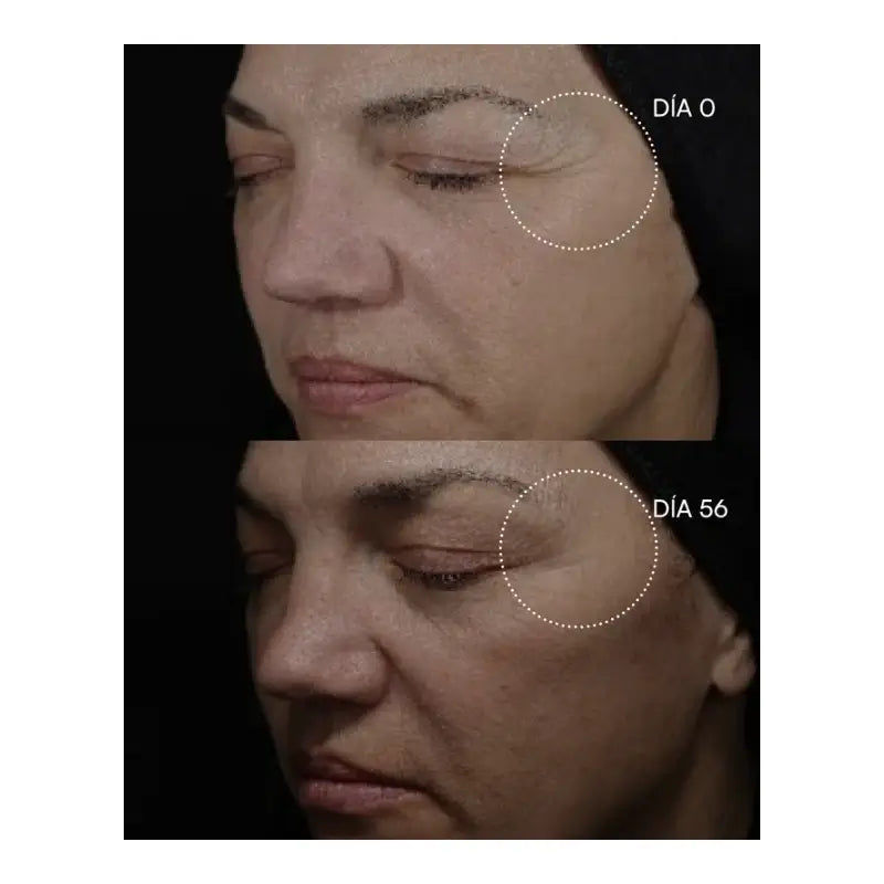 Gema Herrerías 20 Peeling chimico 20 dischi 23 ml
