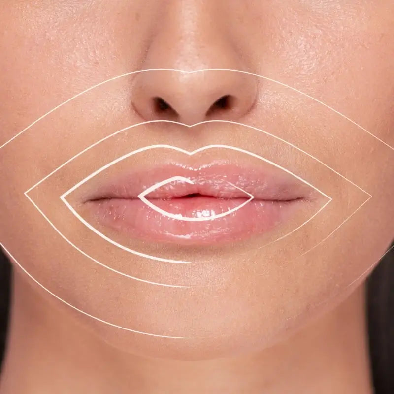 Freshly Volumizzatore Ialuronico per Labbra 5ml