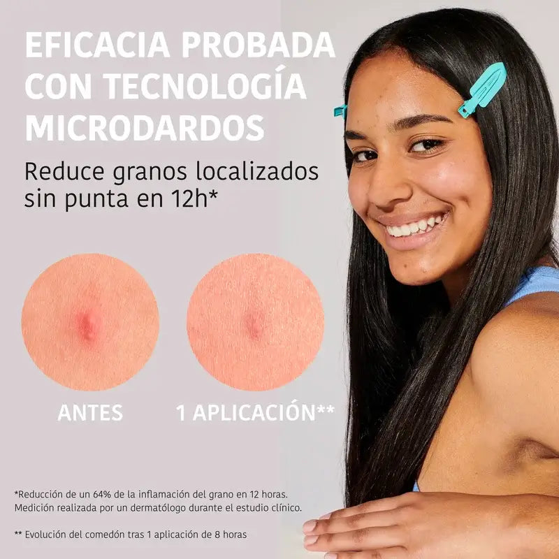 Iroha Nature Cerotti Microdart per pelli a tendenza acneica, 12 pezzi