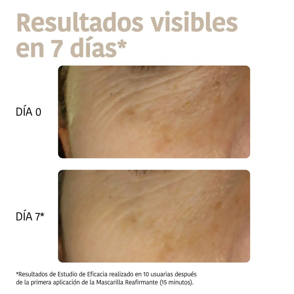 Iroha Nature Triplo Acido Ialuronico Maschera Filler per Viso e Collo, 30 ml