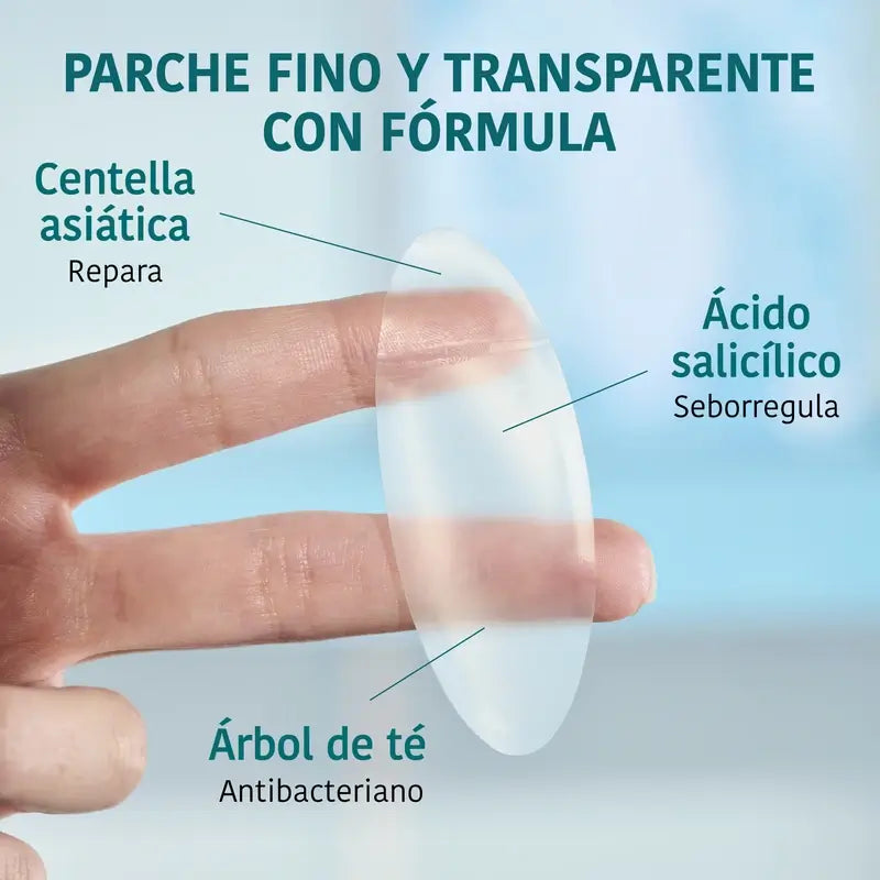 Iroha Nature Xl Patch per brufoli, 5 unità