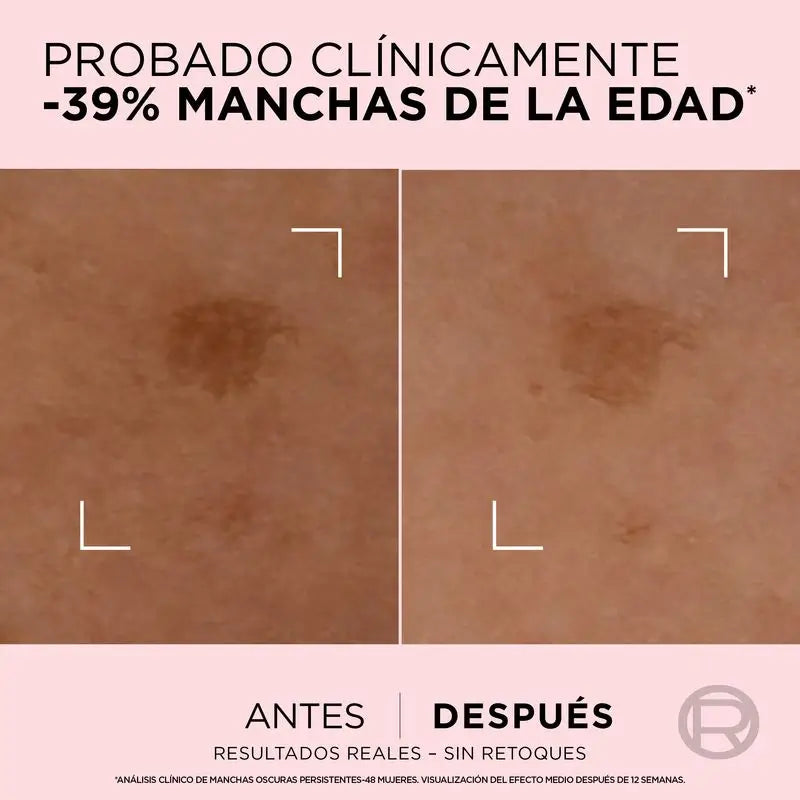 L'Oréal Paris Age Perfect Siero perfezionatore dell'età per pelli mature