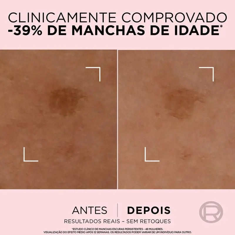 L'Oréal Paris Age Perfect Siero perfezionatore dell'età per pelli mature