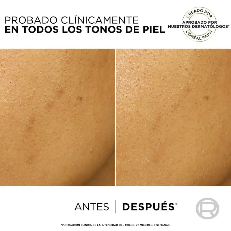 L'Oréal Paris Bright Reveal Peel esfoliante anti-macchie