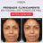 L'Oréal Paris Revitalift Filler Cream Gel: Acido Ialuronico e 3 Ceramidi, Idratazione Intensa