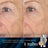 Medik8 Retinal Rewind Cyrstal Retinal 3 30Ml + Crystal Retinal Ceramide 3 15Ml