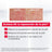 Mixa Balm Cica+, Balsamo riparatore multiuso, 50 ml