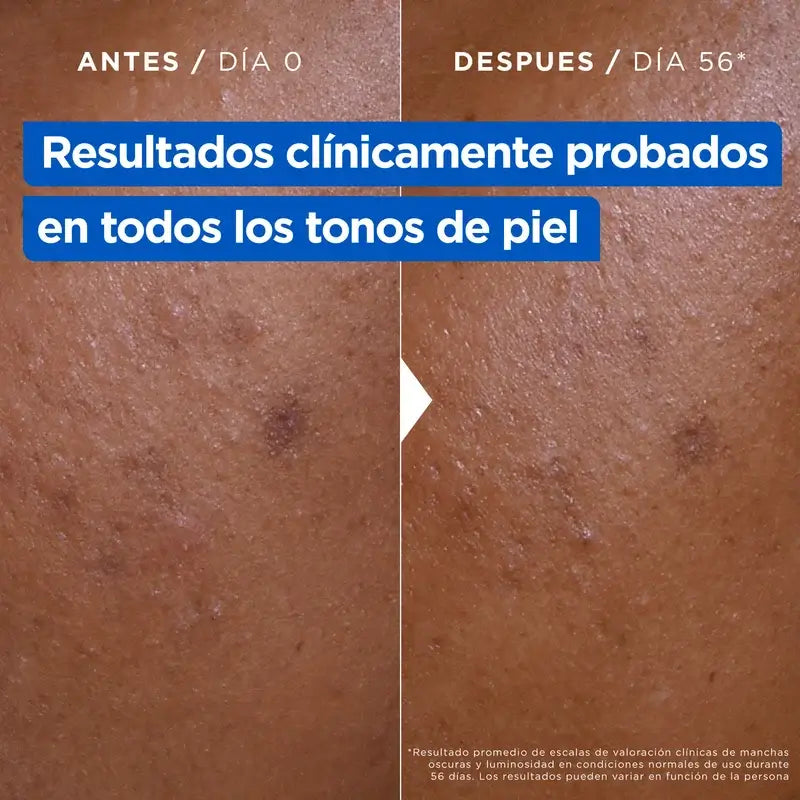 Crema antimacchia alla niacinamide Mixa, 400 ml