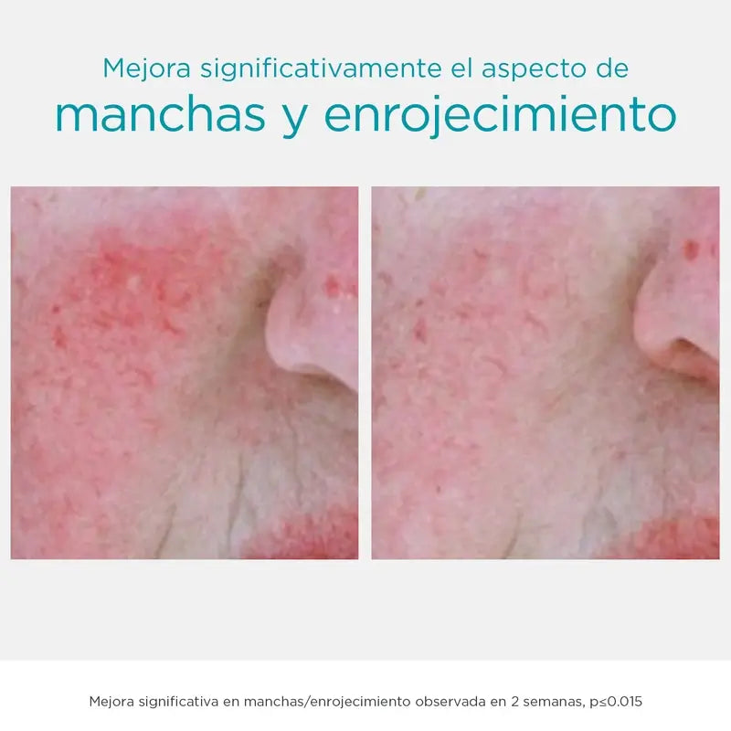 Neostrata Anti-Ageing Anti-Dark Spot Serum, siero anti-macchie con 6% PHA 29g