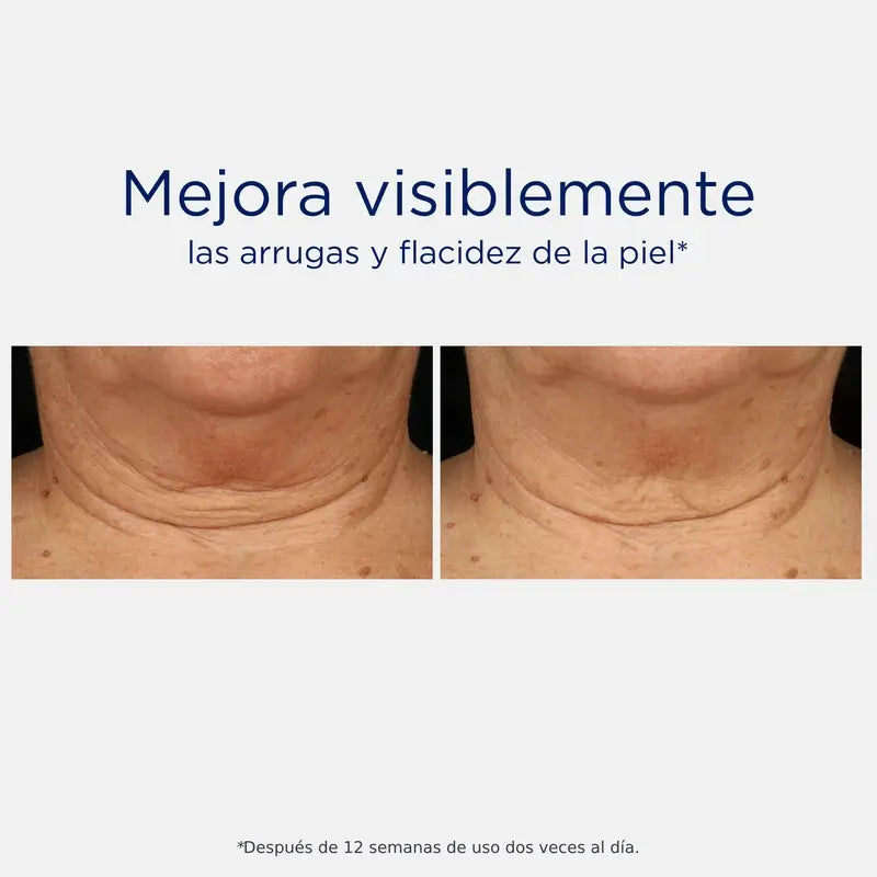 Neostrata Skin Active Tri-Therapy Lifting Serum, siero all'acido ialuronico 30ml