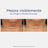 Neostrata Skin Active Tri-Therapy Lifting Serum, siero all'acido ialuronico 30ml