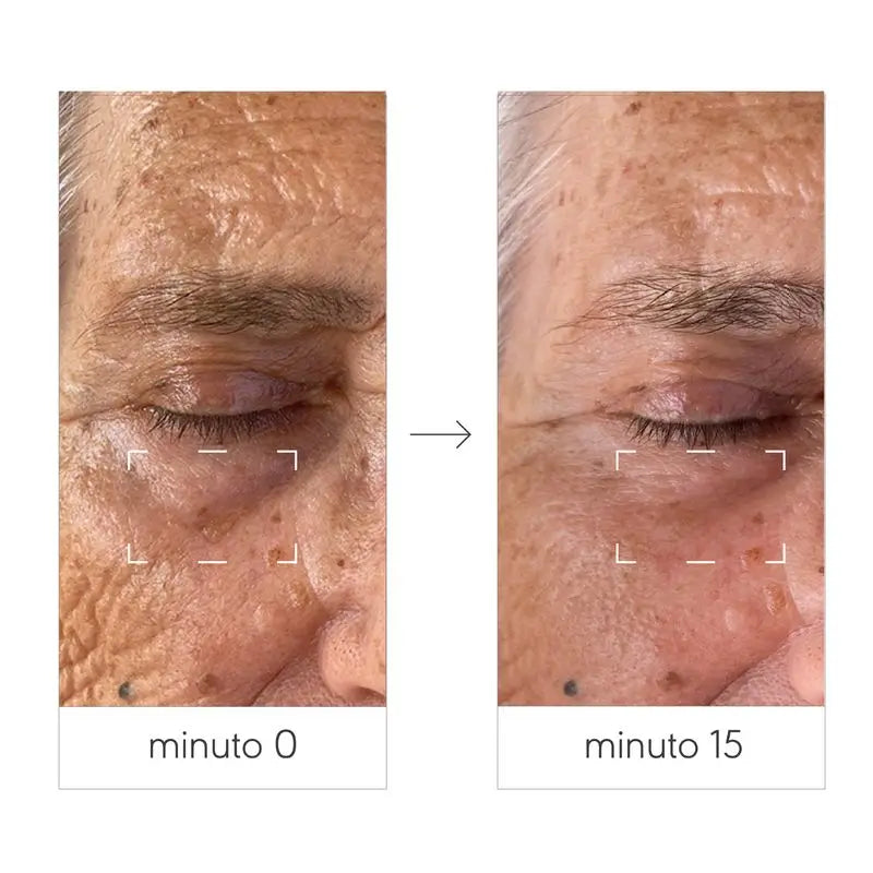 Nieves By Nieves Álvarez Crema rassodante lifting contorno occhi, 15 ml