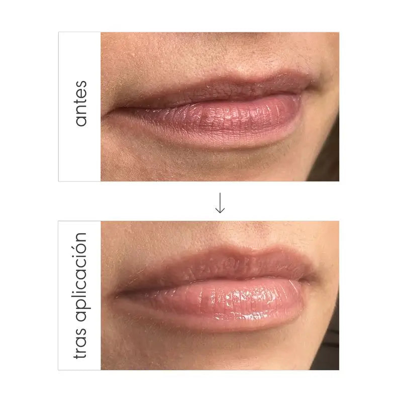 Nieves By Nieves Álvarez Triple Action Lip Elixir Trattamento labbra idratante e volumizzante, 10 ml